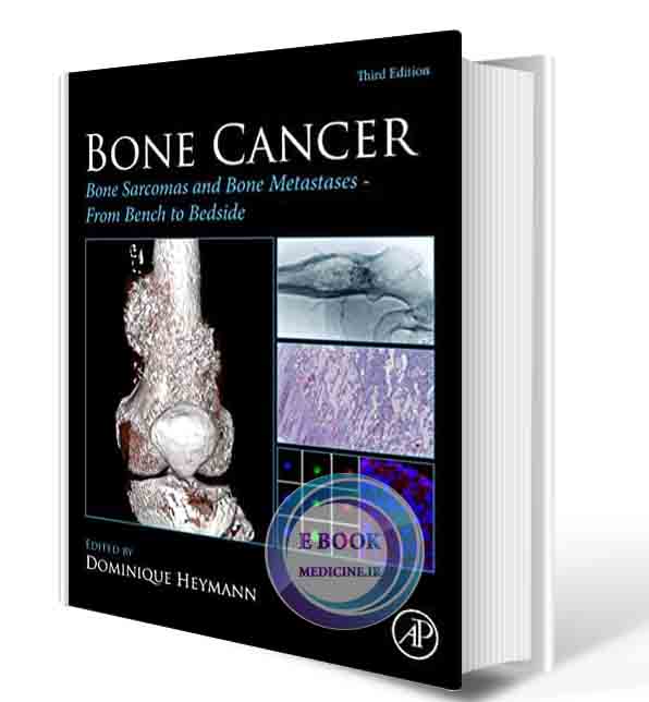 دانلود کتابBone Cancer: Bone Sarcomas and Bone Metastases - From Bench to Bedside 3rd  (ORIGINAL PDF)